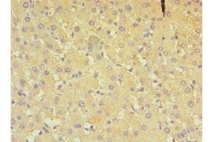 Immunohistochemistry of paraffin-embedded human liver tissue using ABIN7149648 at dilution of 1:100 (ALDH4A1 抗体  (AA 354-563))