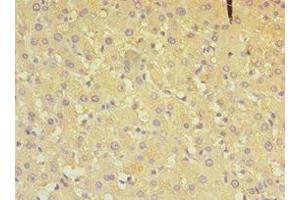 Immunohistochemistry of paraffin-embedded human liver tissue using ABIN7149648 at dilution of 1:100 (ALDH4A1 抗体  (AA 354-563))