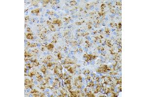 Immunohistochemistry (IHC) image for anti-Chymotrypsinogen B1 (CTRB1) (AA 79-263) antibody (ABIN7266398)