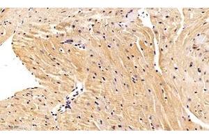 Immunohistochemistry analysis of paraffin-embedded mouse heart using,Nebulette (ABIN7074788) at dilution of 1: 1000 (Nebulette 抗体)