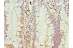 Immunohistochemistry of paraffin-embedded human small intestine tissue using ABIN7172749 at dilution of 1:100 (Protein C8orf4 (TCIM) (AA 1-106) 抗体)