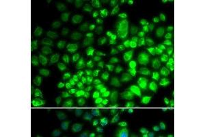 Immunofluorescence analysis of HeLa cells using ST6GAL1 Polyclonal Antibody (ST6GAL1 抗体)