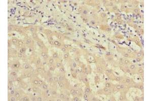 Immunohistochemistry of paraffin-embedded human liver tissue using ABIN7159418 at dilution of 1:100 (MIER2 抗体  (AA 1-545))