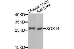 Western blot analysis of extracts of mouse brain and rat liver cells, using SOX14 antibody. (SOX14 抗体)