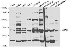 Western Blotting (WB) image for anti-Microcephalin 1 (MCPH1) antibody (ABIN1876660) (MCPH1 抗体)