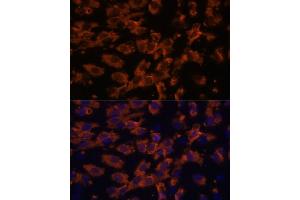 Immunofluorescence analysis of C6 cells using PRX antibody (ABIN7269215) at dilution of 1:100. (Periaxin 抗体  (AA 1250-1350))