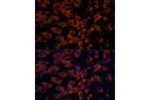 Immunofluorescence analysis of C6 cells using PRX antibody (ABIN7269215) at dilution of 1:100. (Periaxin 抗体  (AA 1250-1350))