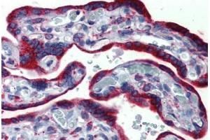 Human, Placenta: Formalin-Fixed Paraffin-Embedded (FFPE) (ERP44 抗体  (C-Term))