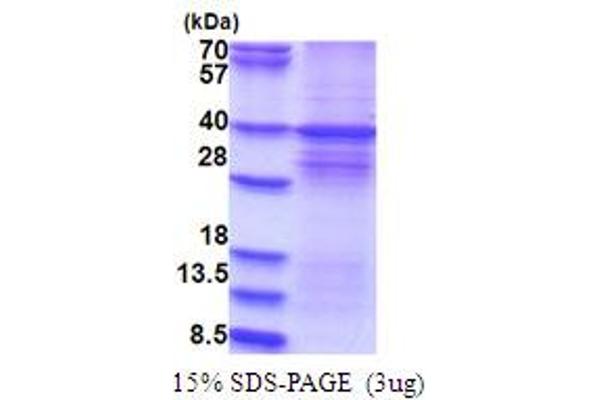 DYRK1A Protein (AA 159-479) (His tag)