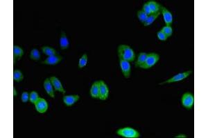 Immunofluorescent analysis of HepG2 cells using ABIN7146589 at dilution of 1:100 and Alexa Fluor 488-congugated AffiniPure Goat Anti-Rabbit IgG(H+L) (Calsyntenin 2 抗体  (AA 473-673))