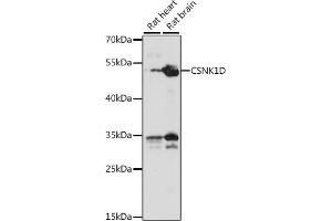 Western blot analysis of extracts of various cell lines, using CSNK1D antibody (ABIN7266100) at 1:1000 dilution. (Casein Kinase 1 delta 抗体  (AA 250-350))