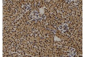ABIN6273457 at 1/100 staining Mouse kidney tissue by IHC-P. (CENPF 抗体  (C-Term))