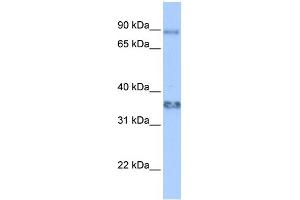 WB Suggested Anti-ZFP64 Antibody Titration:  0. (ZFP64 抗体  (Middle Region))