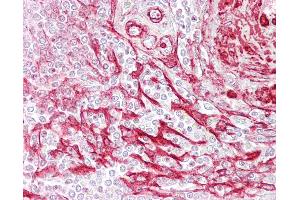 Anti-TAGLN / SM22 antibody IHC of human spleen. (Transgelin 抗体  (C-Term))