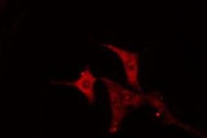 ABIN6274992 staining NIH-3T3 cells by IF/ICC. (Cep76 抗体  (Internal Region))