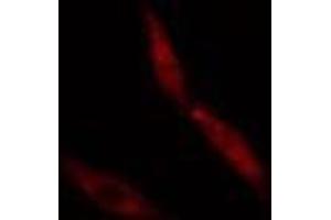 ABIN6274978 staining  Hela cells by IF/ICC.