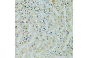 Immunohistochemistry of paraffin-embedded mouse kidney using RCC1 antibody (ABIN5973761) at dilution of 1/100 (40x lens). (RCC1 抗体)