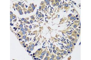 Immunohistochemistry (Paraffin-embedded Sections) (IHC (p)) image for anti-Calcium Modulating Ligand (CAMLG) antibody (ABIN7257333)