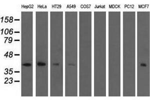 Western blot analysis of extracts (35 µg) from 9 different cell lines by using anti-SH3GL1 monoclonal antibody. (SH3GL1 抗体)