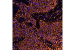 Immunofluorescence (IF) image for anti-CD44 (CD44) (AA 700-742) antibody (ABIN7454002) (Recombinant CD44 抗体  (AA 700-742))