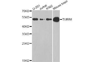 Western blot analysis of extracts of various cell lines, using TUBB8 antibody (ABIN5974843) at 1/1000 dilution. (Tubulin, beta 8 抗体)