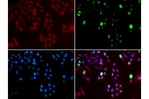 Immunofluorescence analysis of GFP-RNF168 transgenic U2OS cells using FANCD2 antibody (ABIN5971101). (FANCD2 抗体)