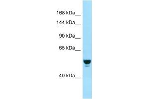 Western Blotting (WB) image for anti-RAB GTPase Activating Protein 1 (RABGAP1) (N-Term) antibody (ABIN2499655) (RABGAP1 抗体  (N-Term))