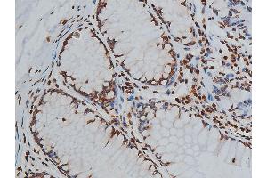 ABIN6267568 at 1/200 staining human colon tissue sections by IHC-P. (Histone 3 抗体  (H3K9ac))