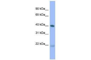 PRKACA antibody used at 0. (PRKACA 抗体  (N-Term))