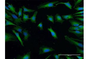 Immunofluorescence of purified MaxPab antibody to SH3GLB2 on HeLa cell. (SH3GLB2 抗体  (AA 1-395))