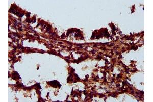 IHC image of ABIN7157204 diluted at 1:200 and staining in paraffin-embedded human lung tissue performed on a Leica BondTM system.