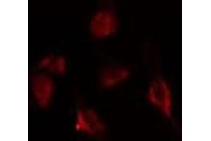 ABIN6275397 staining  293 cells by IF/ICC. (DDX20 抗体  (Internal Region))