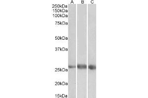 ABIN4902613 (1µg/ml) staining of Heart (A), Kidney (B) and Lung (C) lysates (35µg protein in RIPA buffer). (EGFL7 抗体)