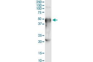 Immunoprecipitation of PORCN transfected lysate using anti-PORCN MaxPab rabbit polyclonal antibody and Protein A Magnetic Bead , and immunoblotted with . (PORCN 抗体  (AA 1-450))