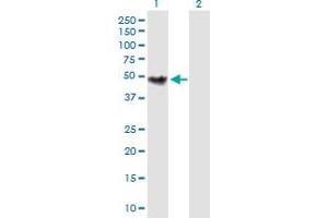 Western Blot analysis of CHKB expression in transfected 293T cell line by CHKB MaxPab polyclonal antibody. (CHKB 抗体  (AA 1-395))