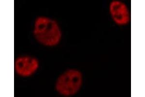 ABIN6269383 staining HeLa cells by IF/ICC. (ATRIP 抗体  (N-Term))