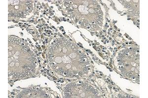 ABIN6256682 and ABIN6267213 at 1/100 staining human normal colon tissue by IHC-P.