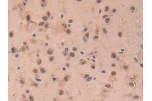 Detection of GFAP in Mouse Brain Tissue using Polyclonal Antibody to Glial Fibrillary Acidic Protein (GFAP) (GFAP 抗体  (AA 108-211))