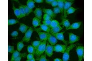 IF analysis of GGA3 using anti-GGA3 antibody (ABIN7602337).