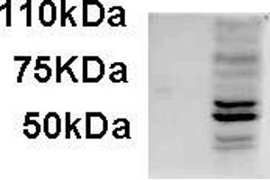AP22454PU-N AIM2 antibody staining of IFNbeta-treated WI-38 lysate (35µg protein in RIPA buffer). (AIM2 抗体  (C-Term))
