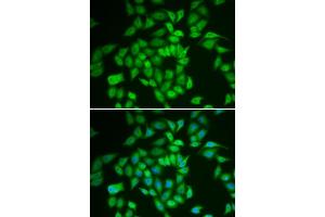 Immunofluorescence analysis of HeLa cells using CSNK1E antibody (ABIN6128970, ABIN6139116, ABIN6139117 and ABIN7101448). (CK1 epsilon 抗体  (AA 247-416))