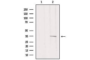 Western blot analysis of extracts from 293, using MSHR Antibody. (MC1 Receptor 抗体  (C-Term))