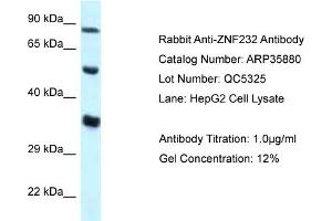 WB Suggested Anti-ZNF232 Antibody   Titration: 1. (ZNF232 抗体  (N-Term))