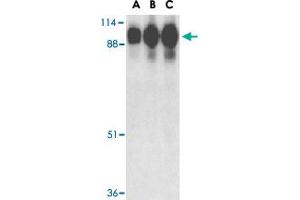 Western blot analysis of ACE2 in human kidney tissue lysate with ACE2 polyclonal antibody  at (A) 0. (ACE2 抗体  (Internal Region))