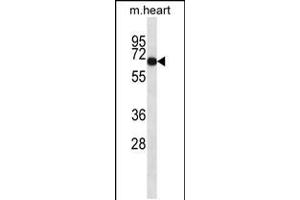 Western blot analysis in mouse heart tissue lysates (35ug/lane). (ADCK1 抗体  (C-Term))