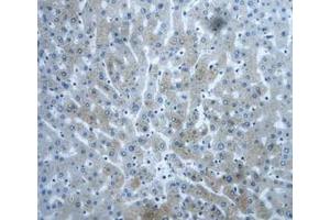 IHC-P analysis of Human Liver Tissue, with DAB staining. (DVL1 抗体  (AA 150-285))
