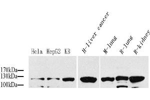 Western Blot analysis of various samples using COL1A1 Polyclonal Antibody at dilution of 1:1000.