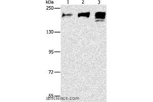 Western blot analysis of Human ileum adenocarcinoma tissue, Human testis and prostate tissue, using ACE Polyclonal Antibody at dilution of 1:240 (Angiotensin I Converting Enzyme 1 抗体)