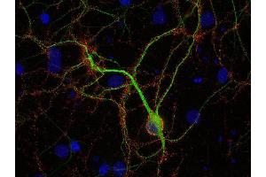Indirect immunostaining of PFA fixed rat hippocampus neurons with anti-amphiphysin (dilution 1 : 500; red) and mouse anti-MAP 2 (cat. (Amphiphysin 抗体)