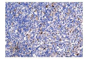 IHC analysis of Galectin 3/LGALS3 using anti Galectin 3/LGALS3 antibody (ABIN6719486).